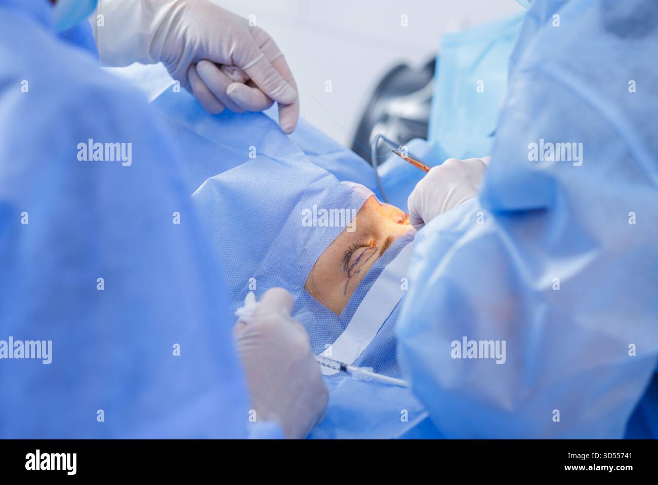 Surgeons close an upper eyelid incision during blepharoplasty under a ...
