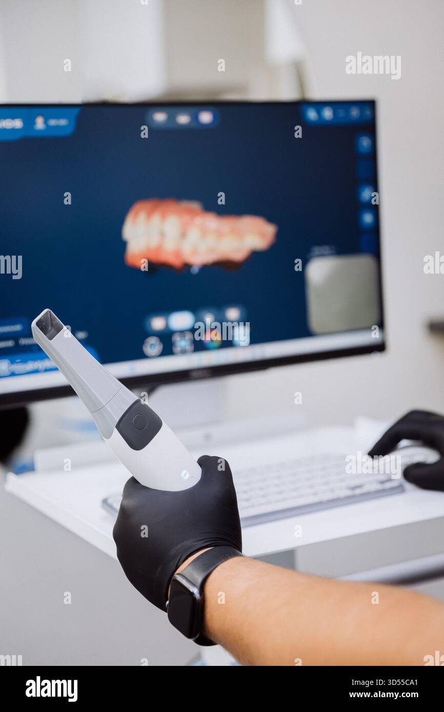 Teeth Scanner Machine Intraoral scanner with 3D teeth model on monitor during digital dental ...