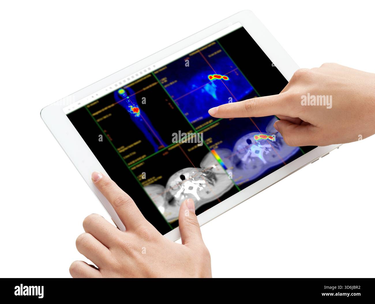 Hand interacting with tablet displaying PET CT scans. Multiview ...