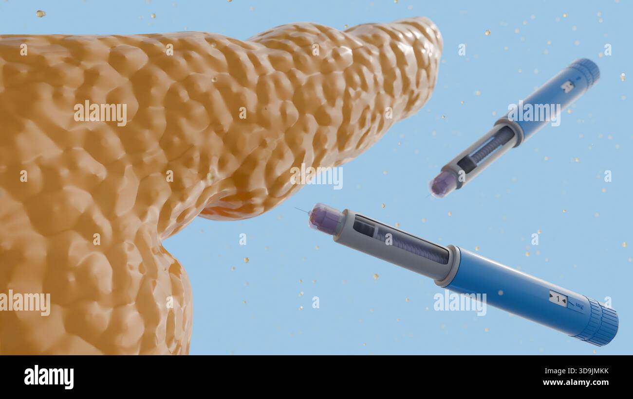 A 3D rendering of the human pancreas and several blue and purple auto ...