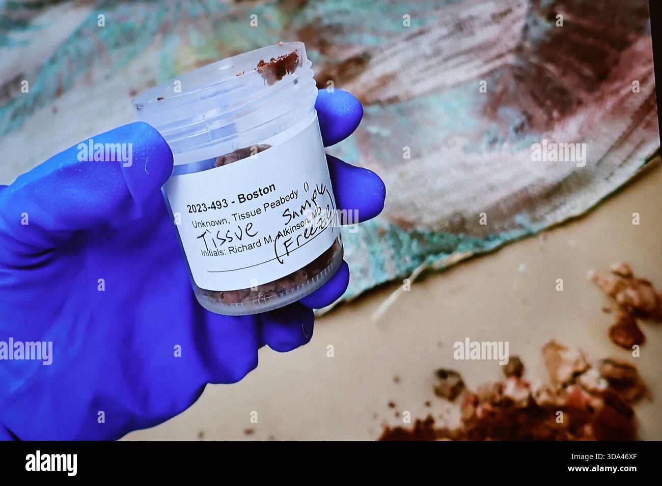 An evidence photo showing tissue evidence recovered from a piece of ...