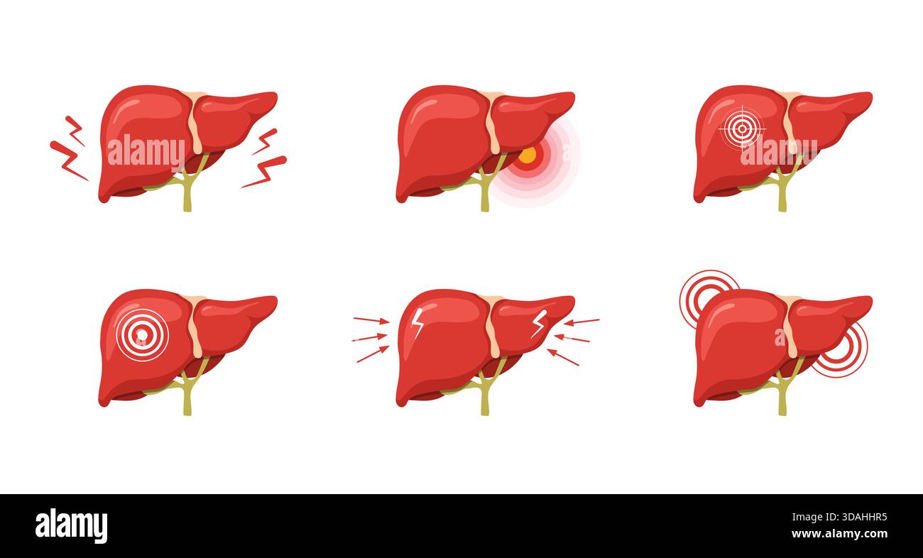 Liver pain. Medical illustration of human liver anatomy. Disease ...