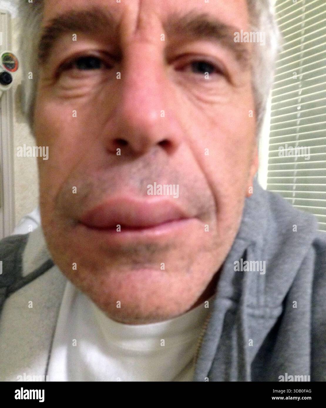 Pics show: Epstein Files Selection images from apparent tranche of 95000  Jeffrey Epstein with a swollen lip     Release by House Oversight Committee Stock Photo