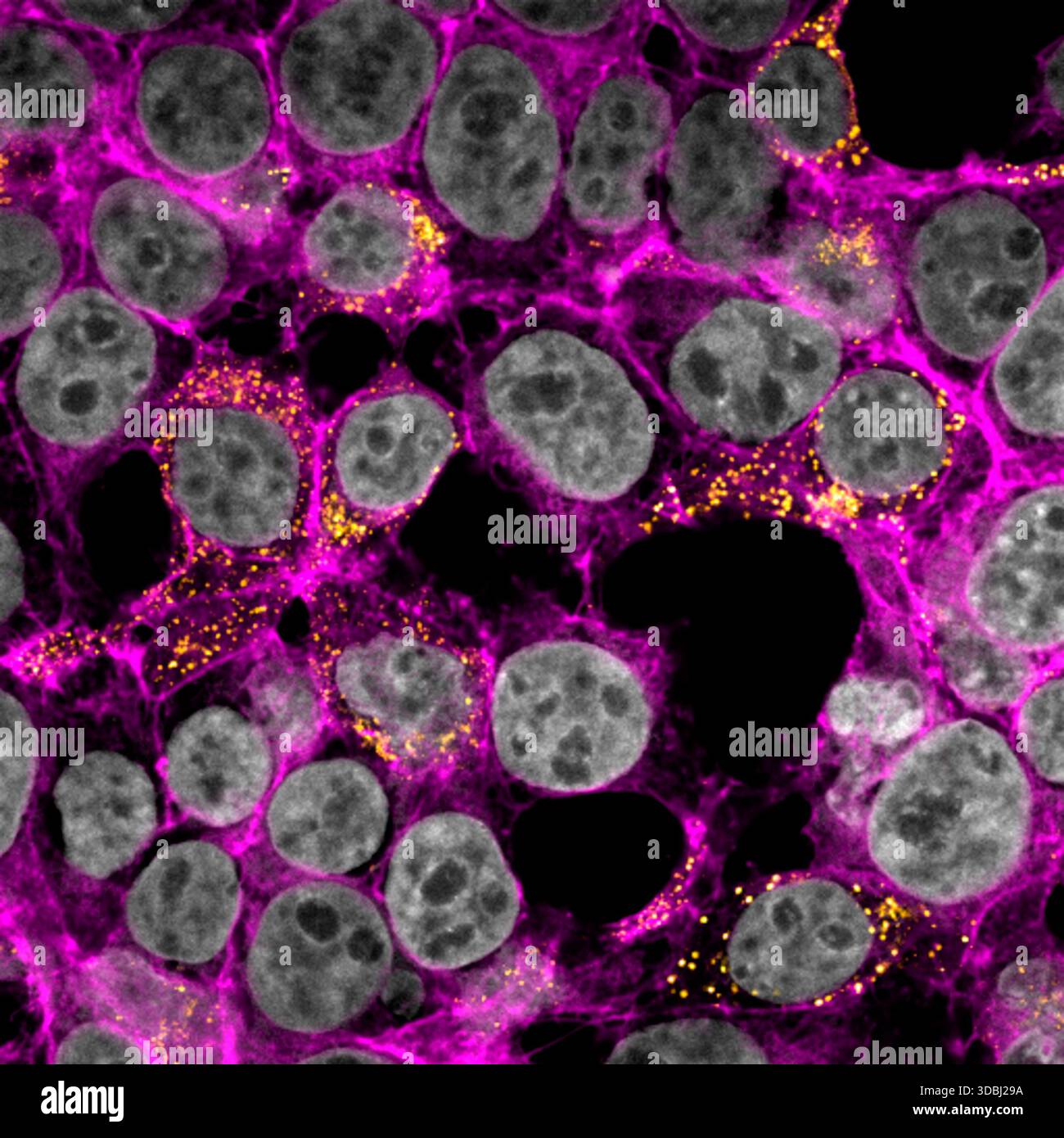 Confocal fluorescence micrograph of HEK293T human embryonic kidney ...