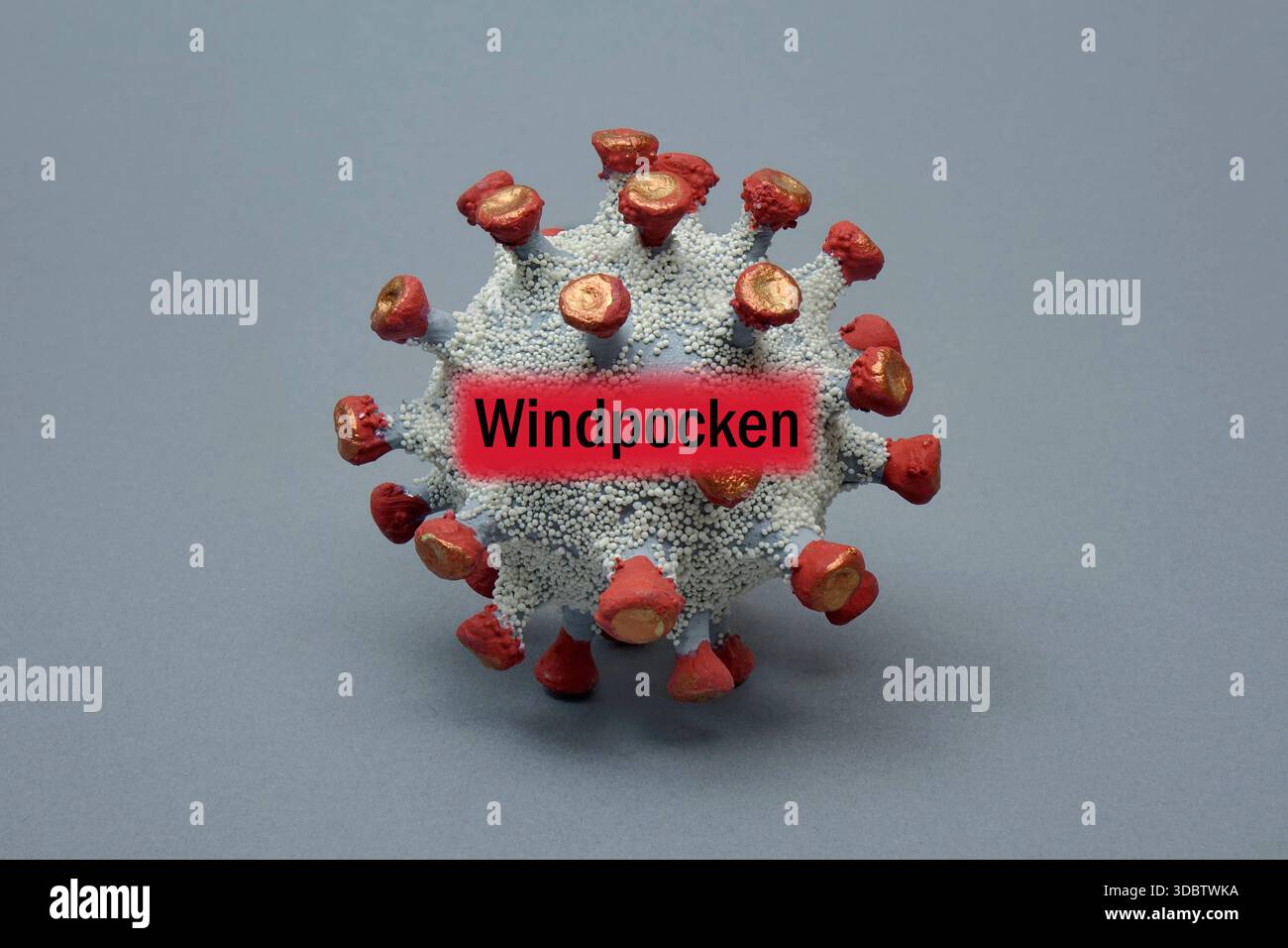 Chickenpox Lettering Virusmodell mit Schriftzug Windpocken Fotomontage: Virusmodell mit ...