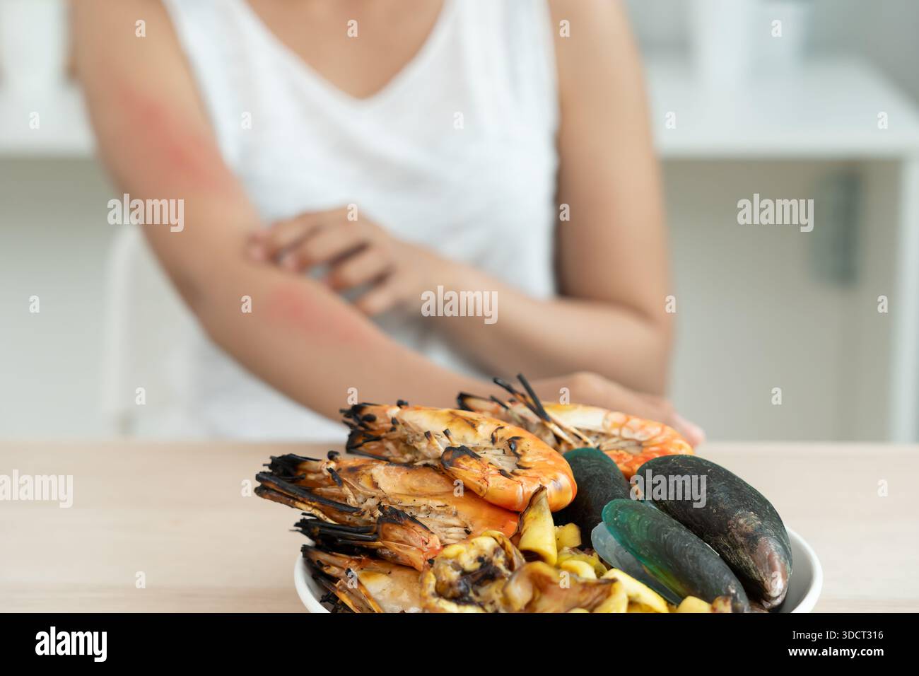 Rask Eating food allergies, women have red skin occur from itching and redness ...