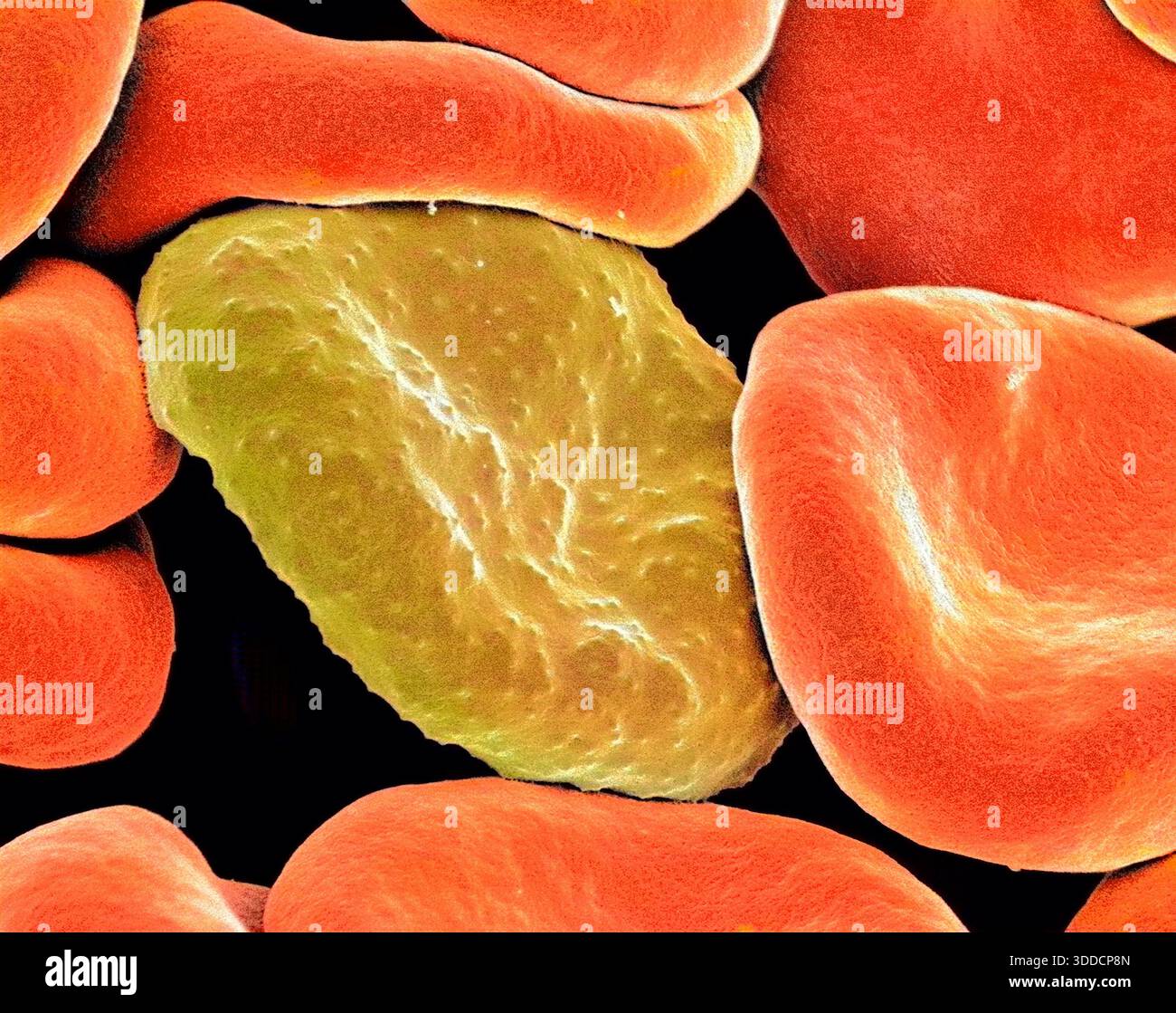 Red blood cell malaria sem hi-res stock photography and images - Alamy