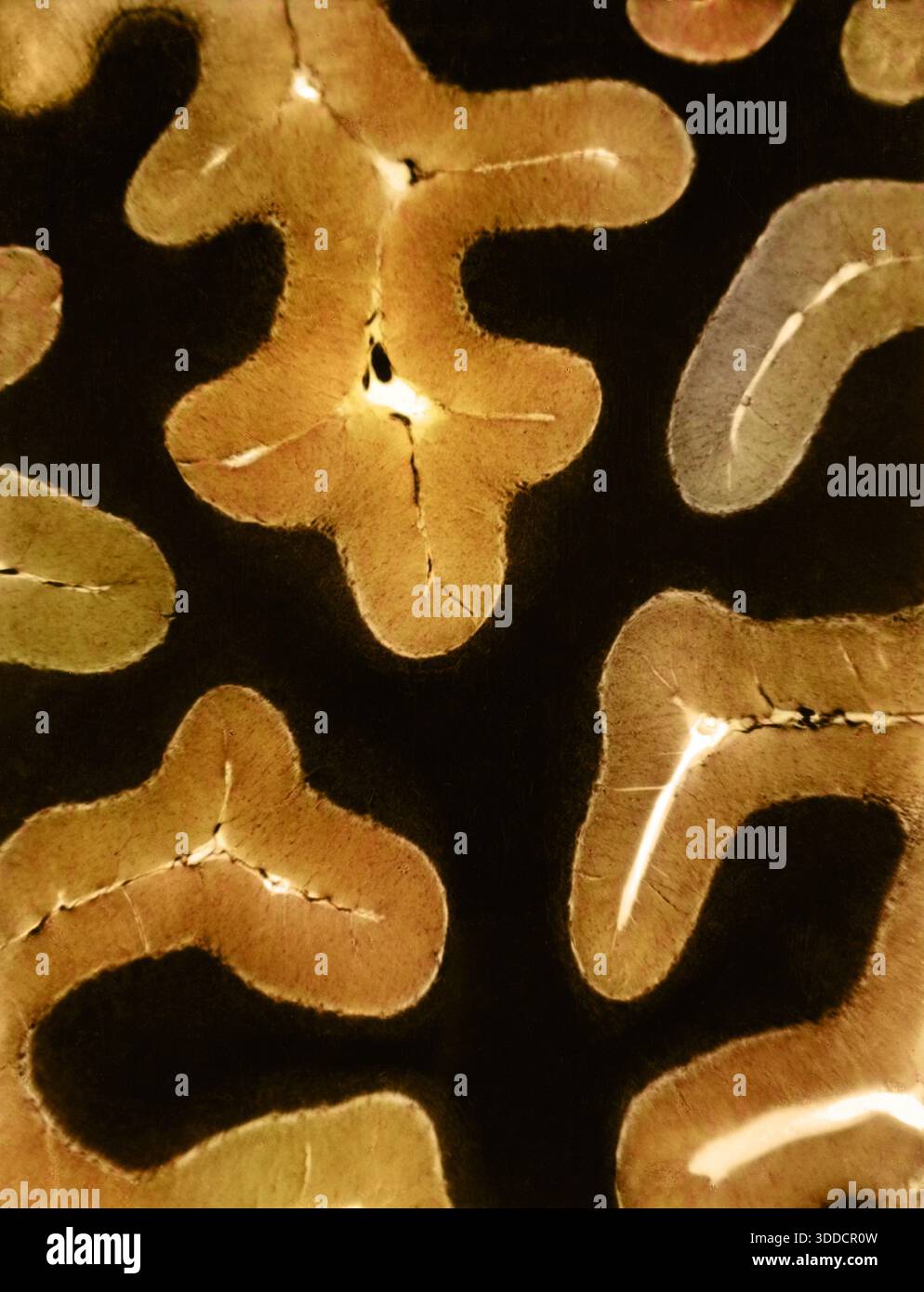Human Cerebellum, light micrograph Stock Photo
