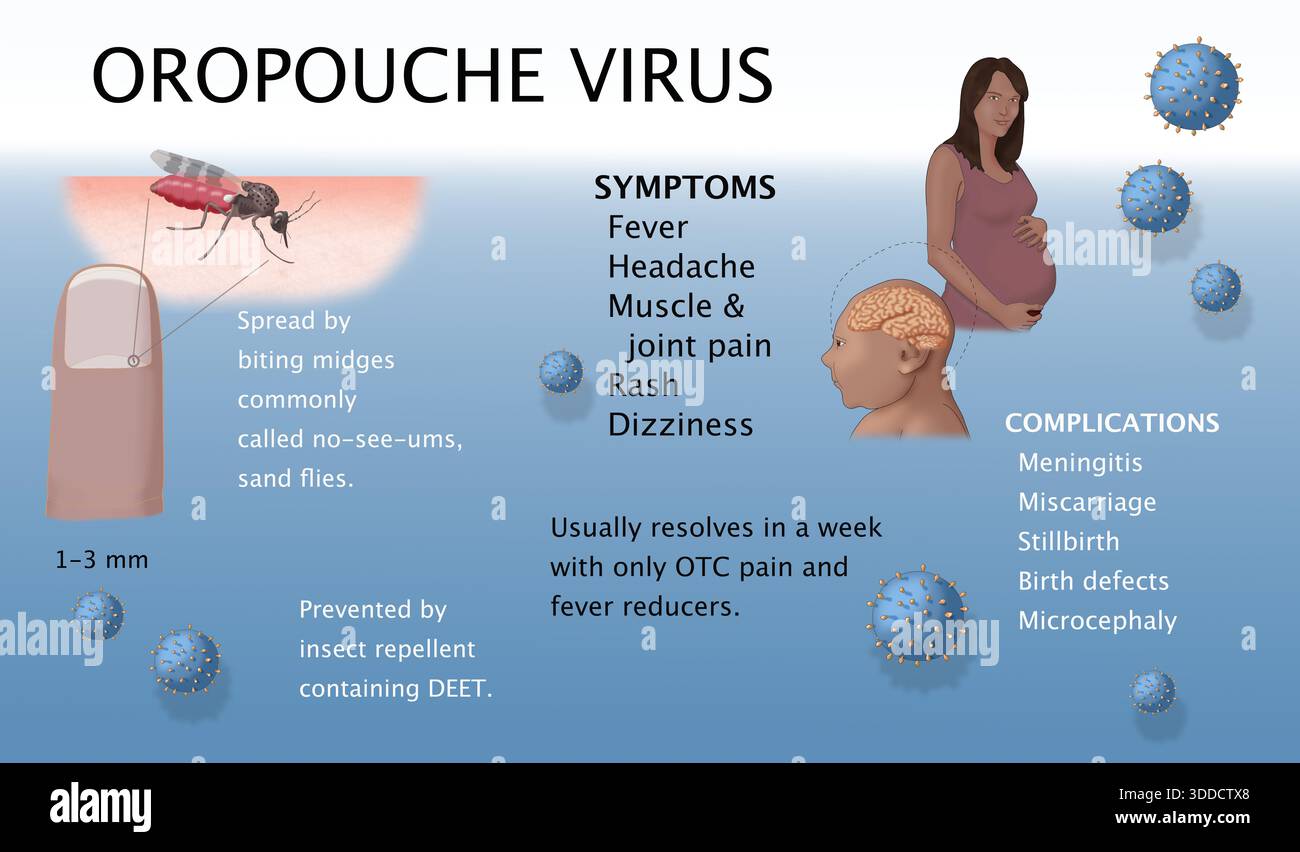 Orph Infection Oropouche virus, its spread, symptoms, and complications, medical ...