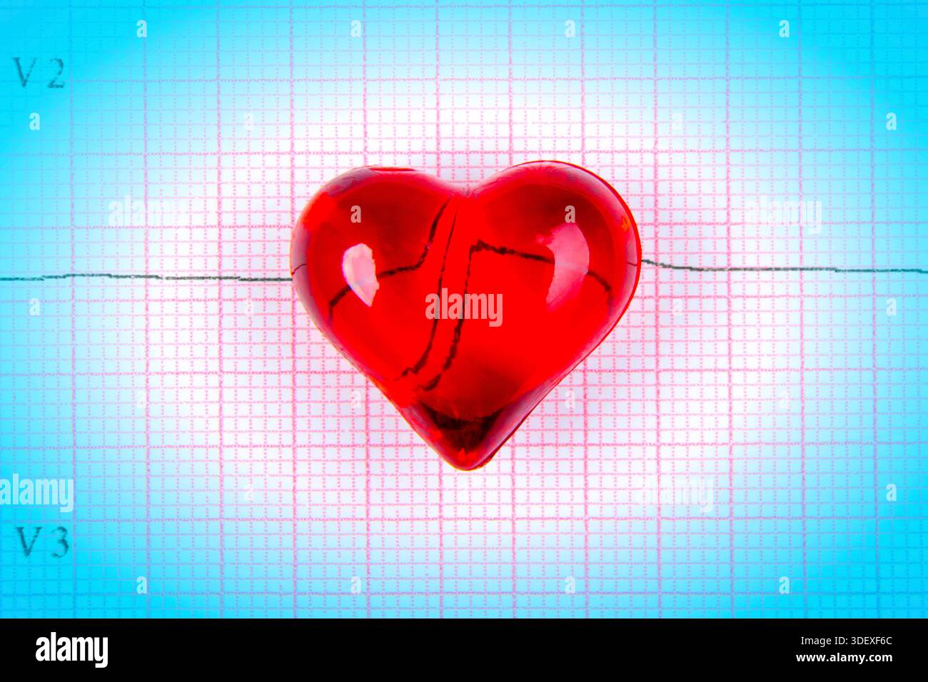 Electrocardiogram graph ekg heart rhythm hi-res stock photography and ...