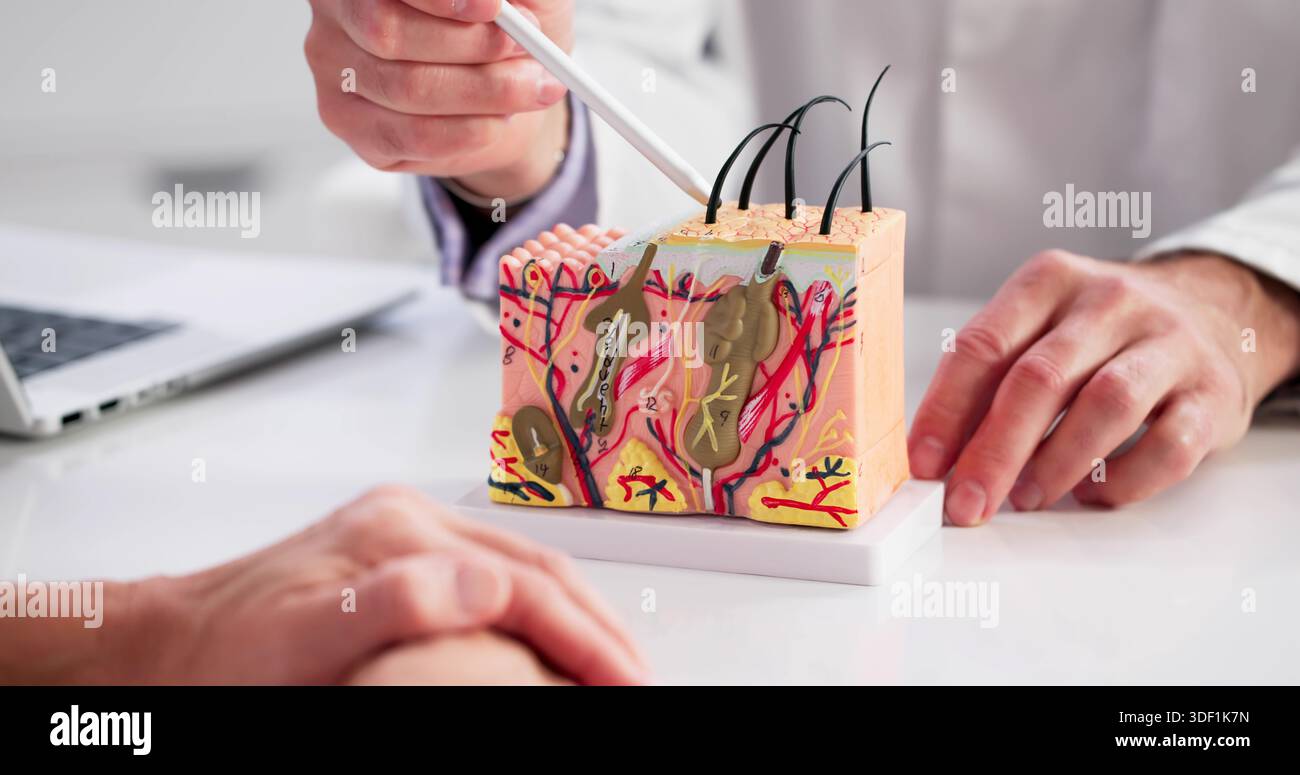 Skin structure explanation dermatologist hi-res stock photography and ...