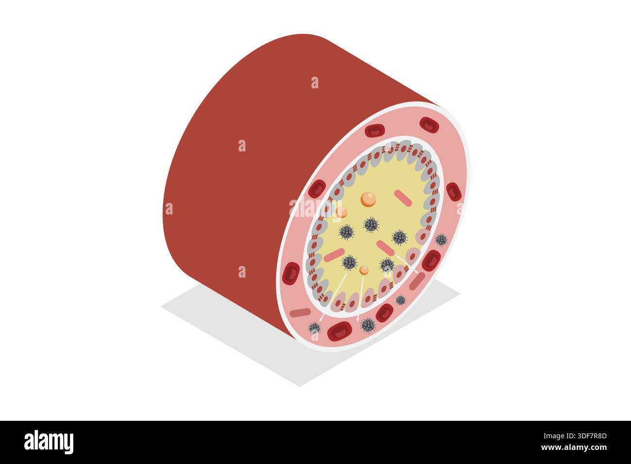 3D Isometric Flat Illustration of Celiac Disease, Gluten Intolerance ...