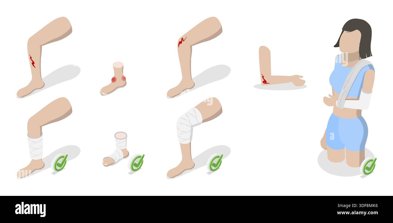 Bandaging Injury 3D Isometric Flat Illustration of How To Heal Injuries, Methods of ...