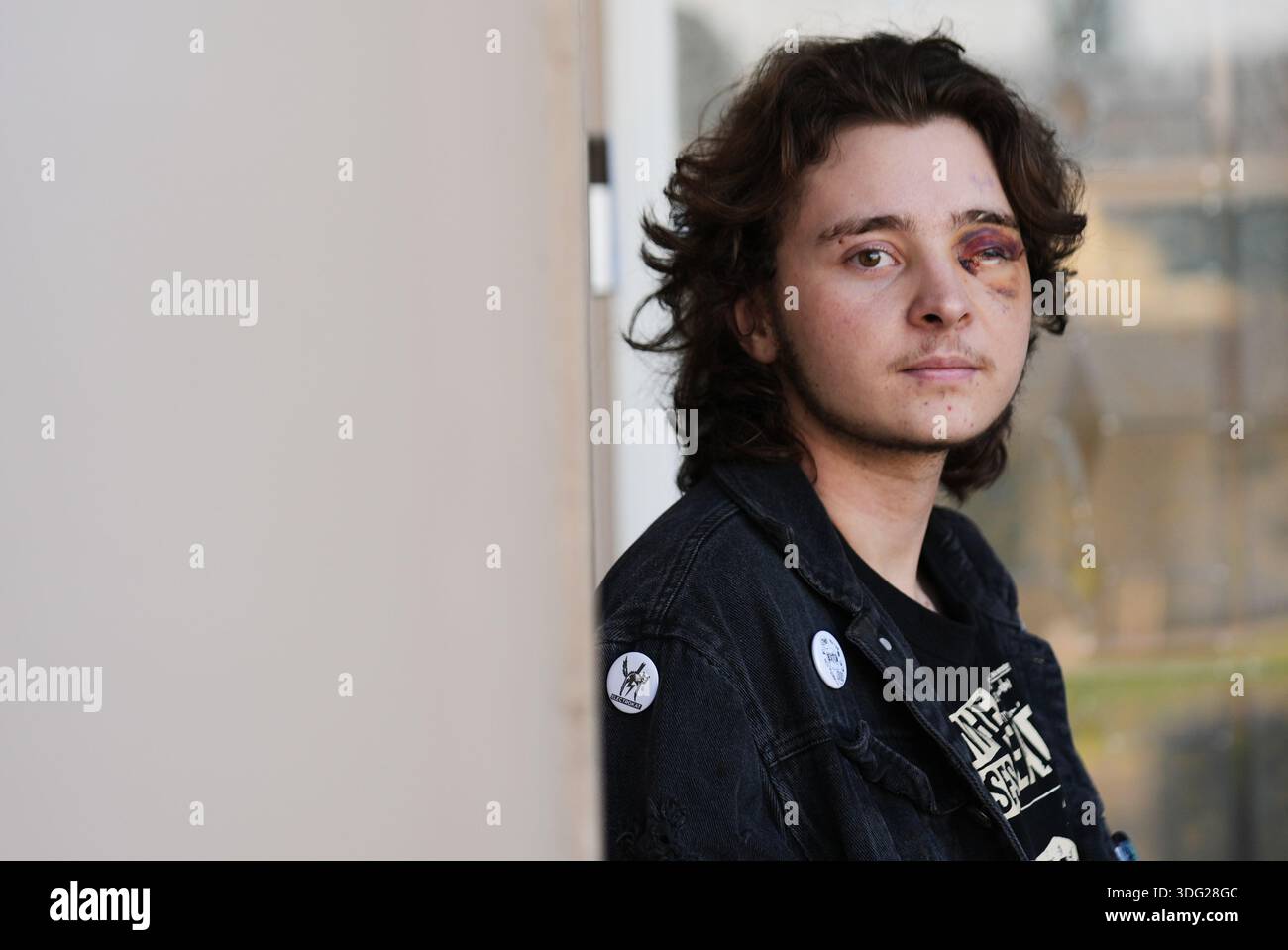 Kaden Ruffer Kaden Rummler, who was injured after being hit with a projectile fired ...