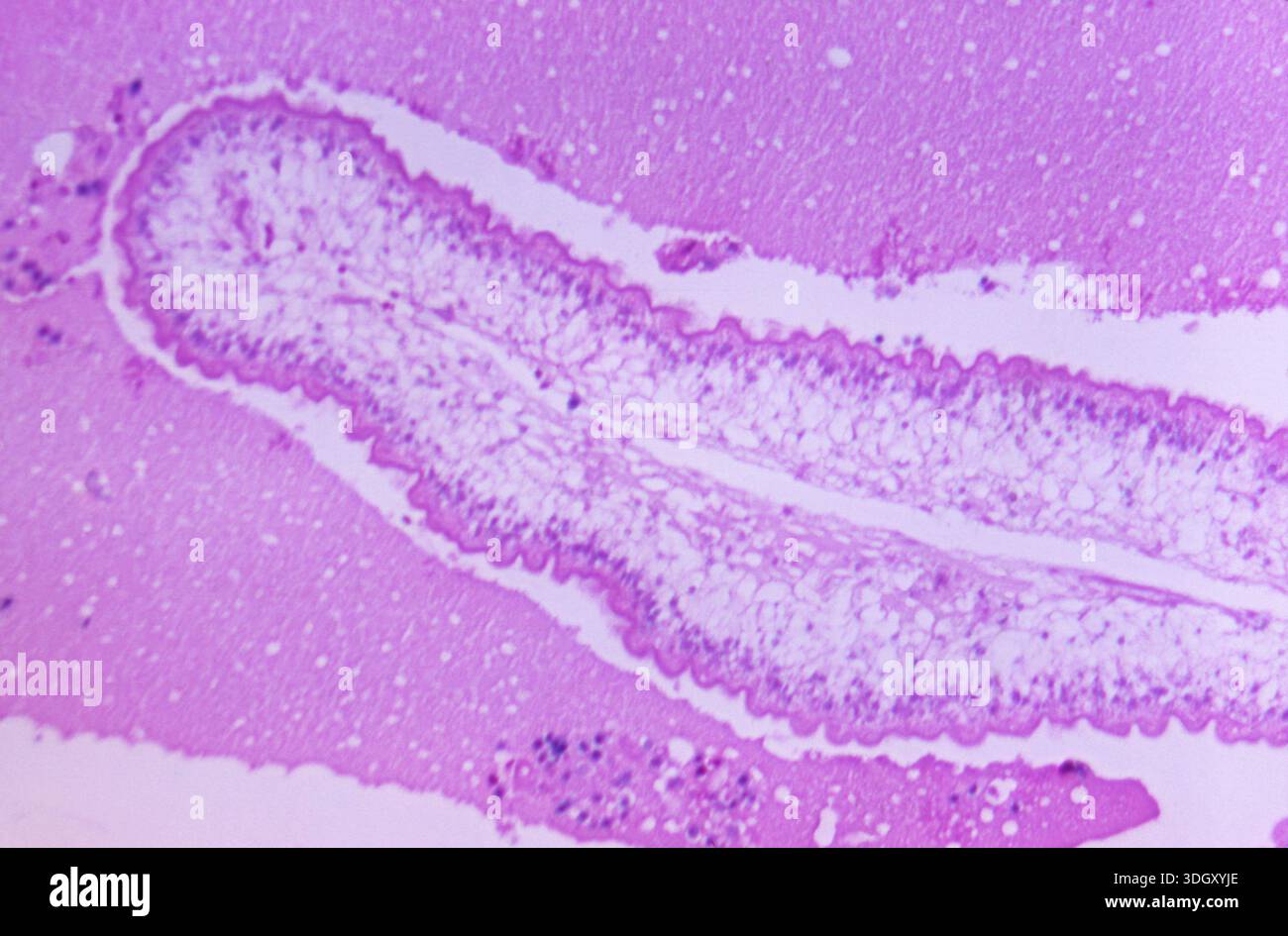 Photomicrograph of brain tissue at 125X magnification shows ...