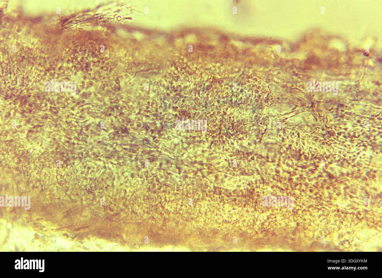 A 475X photomicrograph of a horse hair shaft shows histopathologic ...