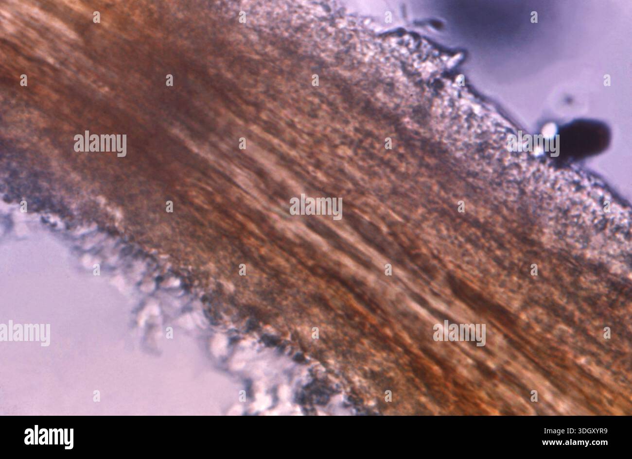 Endotrix A photomicrograph shows an endothrix, a dermatophytic fungal infection ...