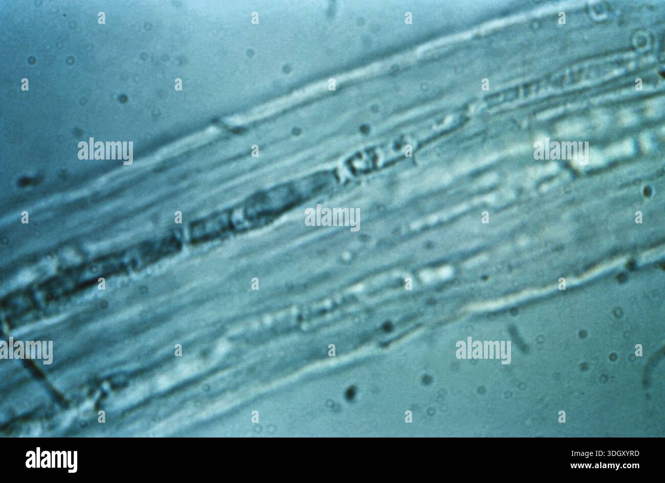 Photomicrograph showing an endothrix dermatophytic infection confined ...