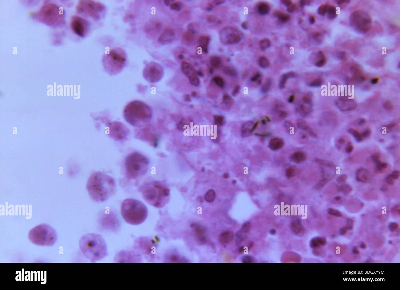 Photomicrograph of an H&E-stained brain tissue section at 900X ...