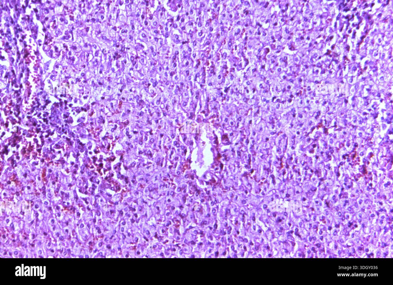 Photomicrograph of an H&E-stained liver tissue section at 100x ...