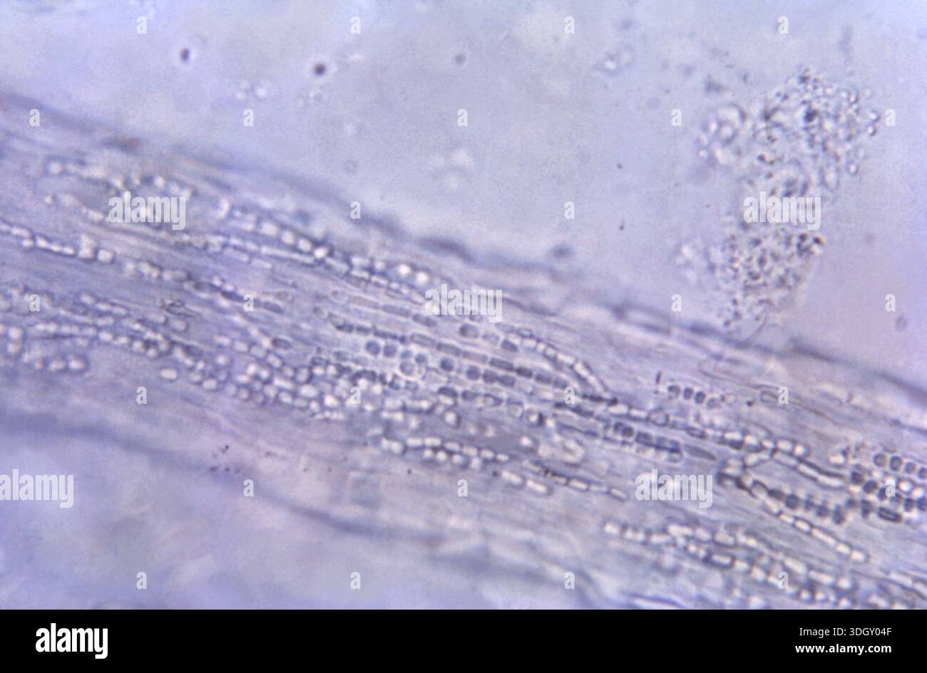 Endotrix A photomicrograph at 475X shows histopathologic features of an equine ...