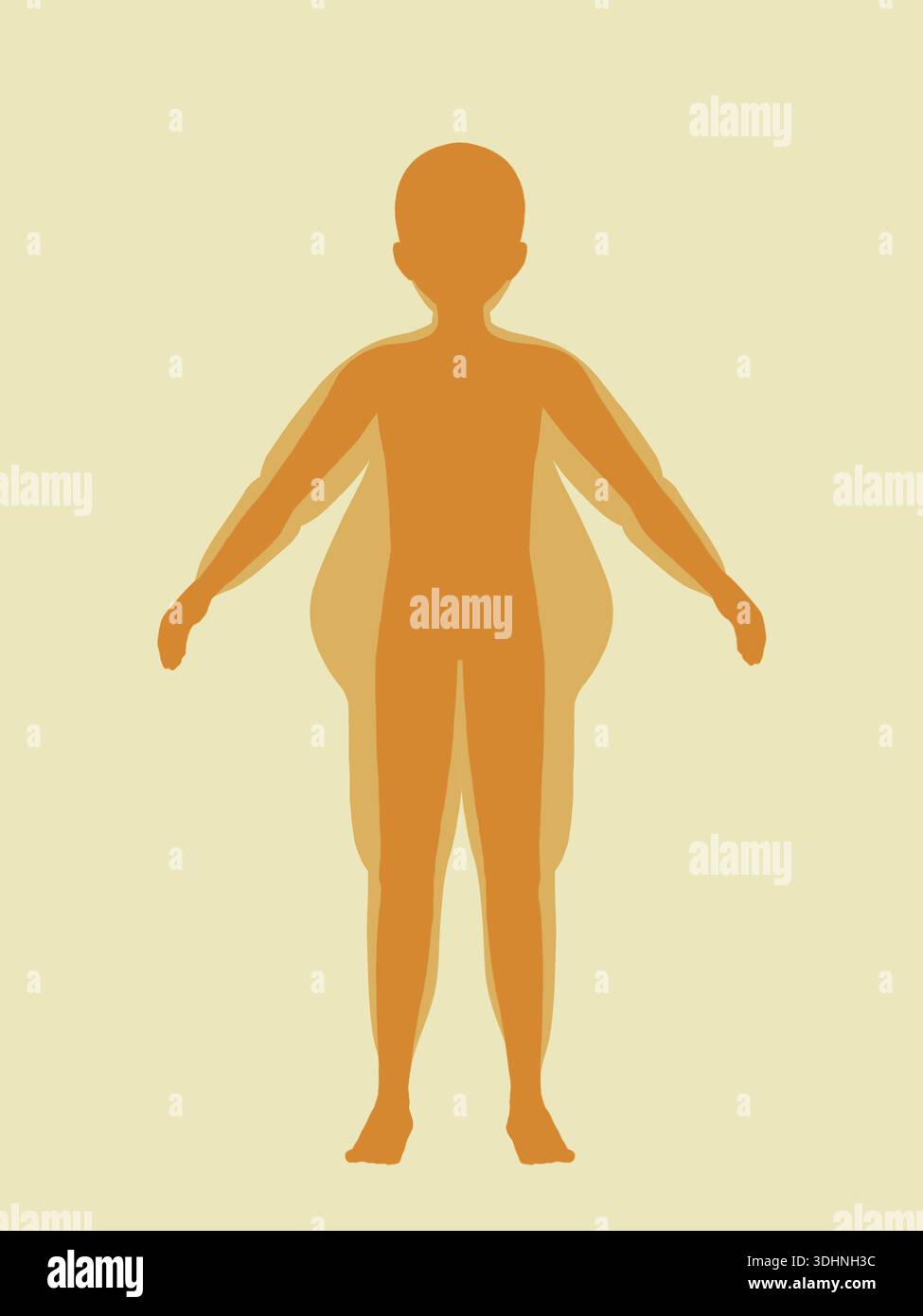 Flat illustration of obesity and overweight concept Stock Photo - Alamy