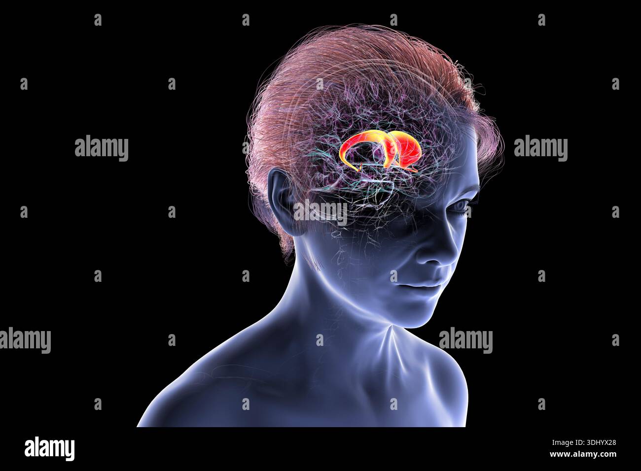 Illustration of the human brain with the caudate nucleus highlighted ...