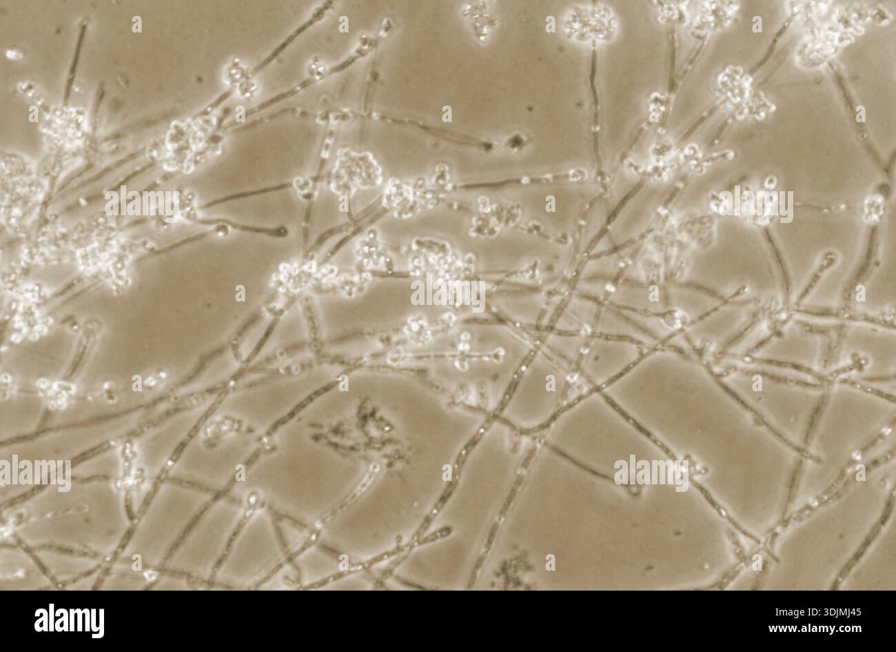 その他 Zoila friendii vercoi f.candida 71mm A 200X phase-contrast photomicrograph shows conidia-laden mycelia