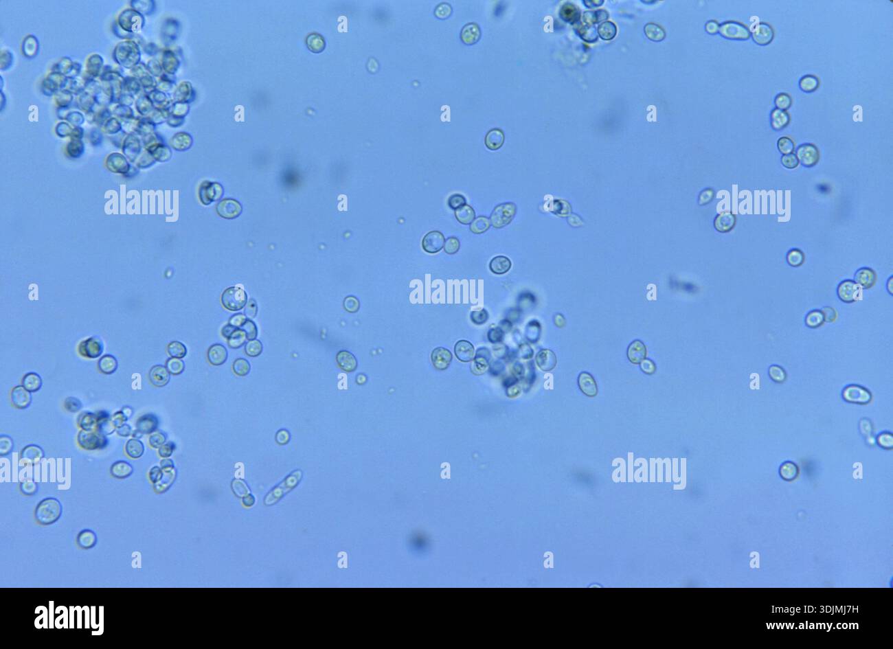 Prepared Microscope Slide, Saccharomyces Cerevisiae, Living Yeast; Whole-mount