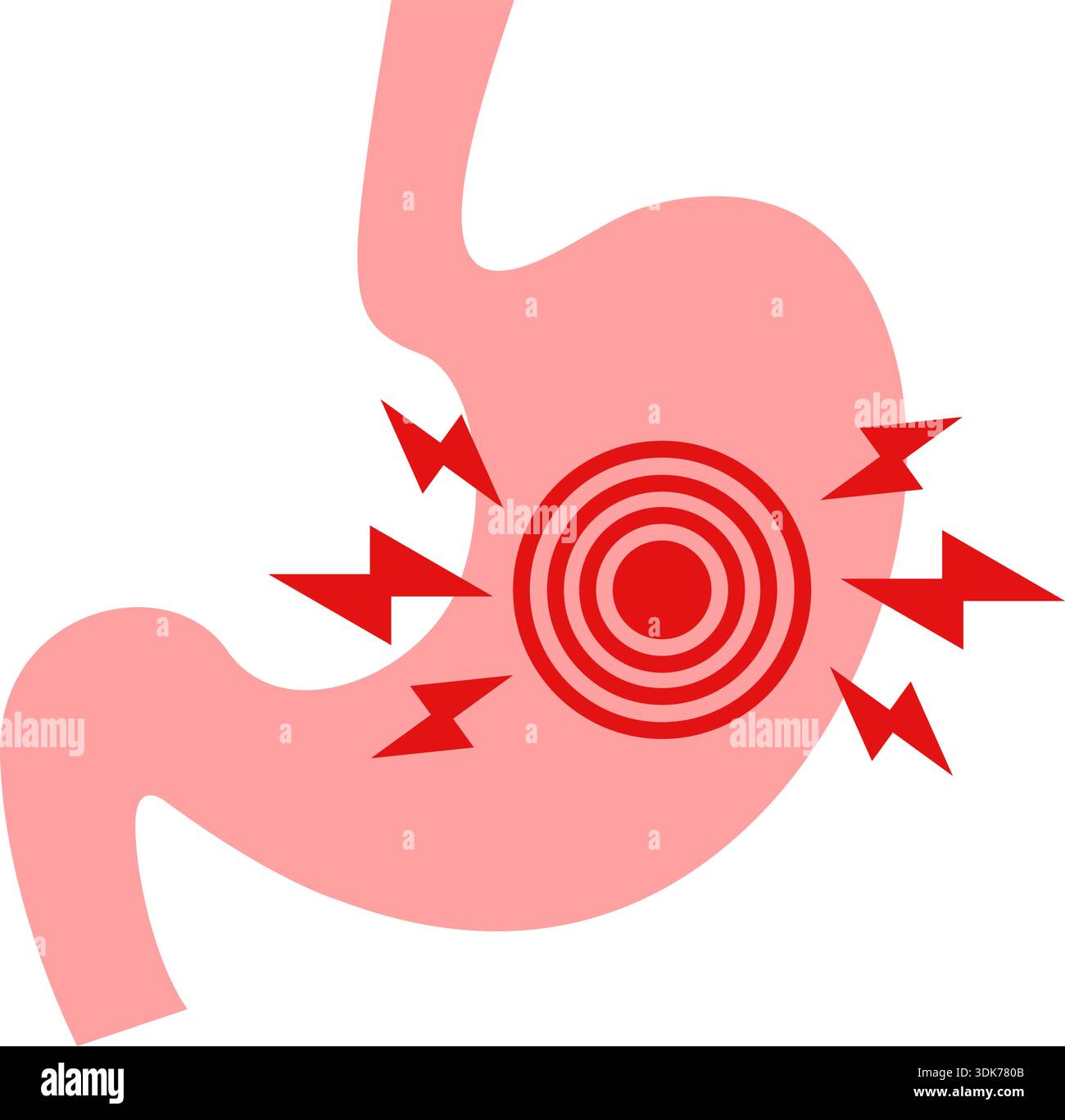 Gerd stomach icon in flat style. Reflux vector illustration on isolated ...