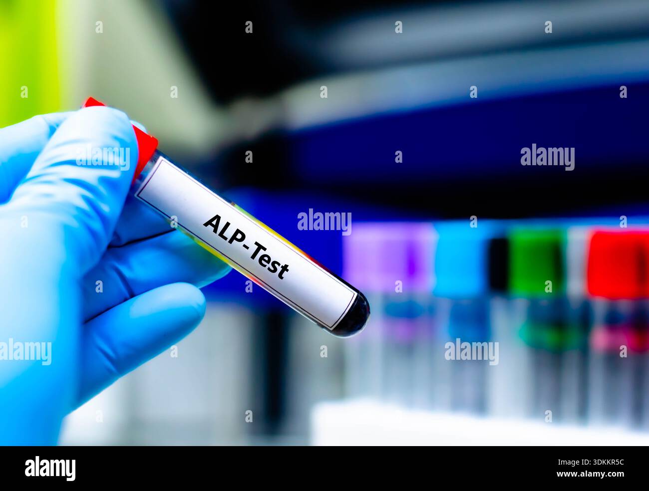 Alp blood test hi-res stock photography and images - Alamy