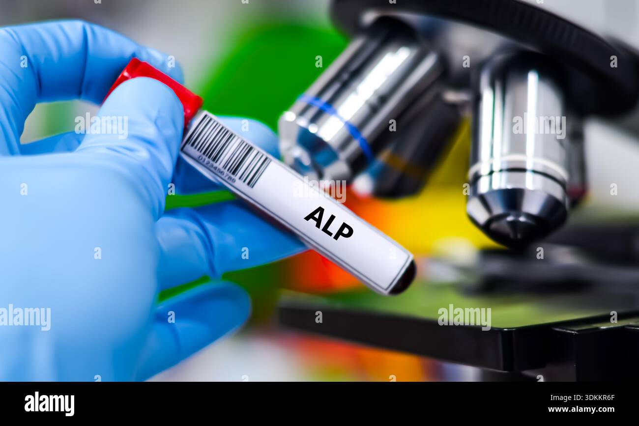 Blood sample tube for ALP test analysis Stock Photo - Alamy