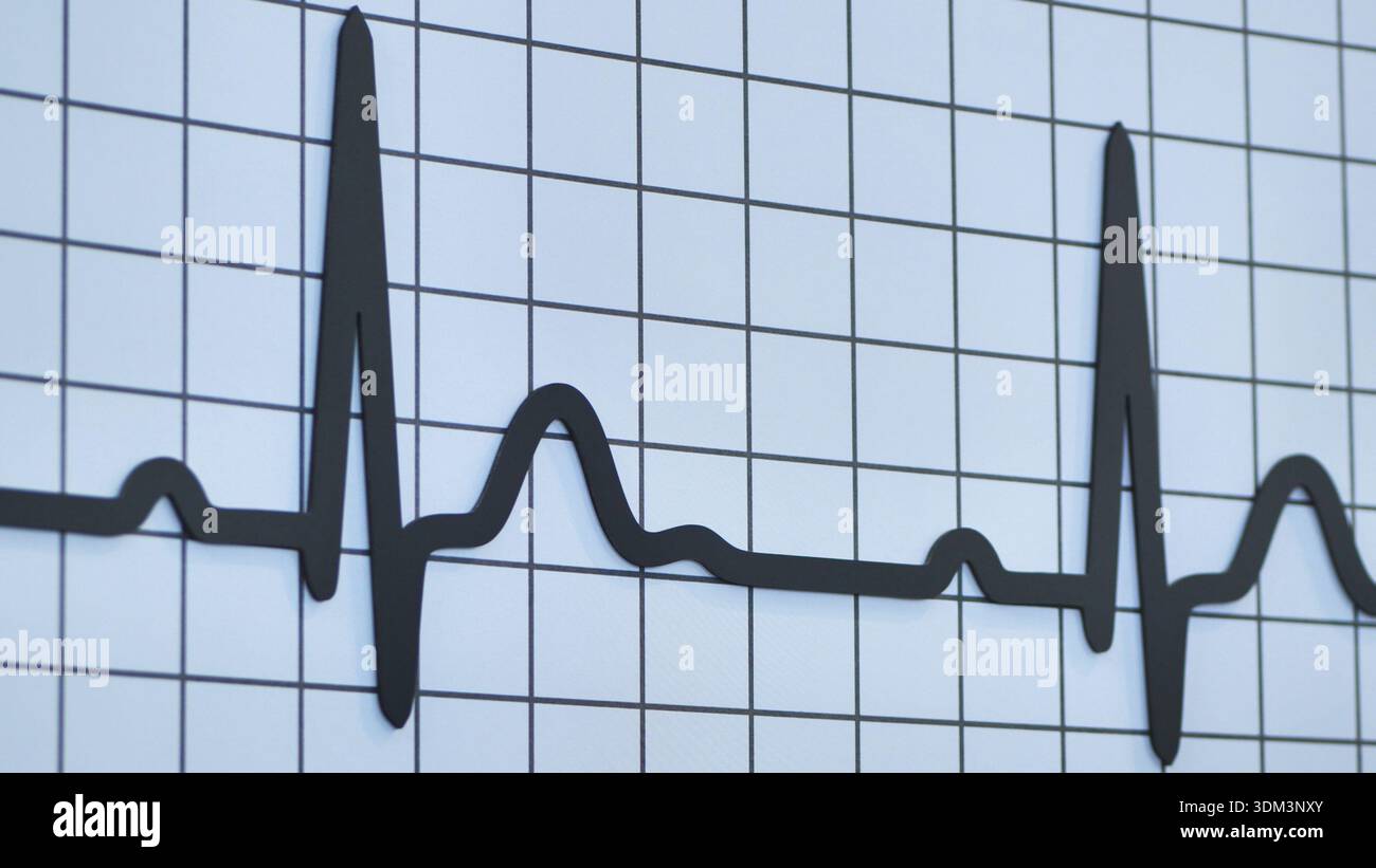 Normal ecg hi-res stock photography and images - Alamy