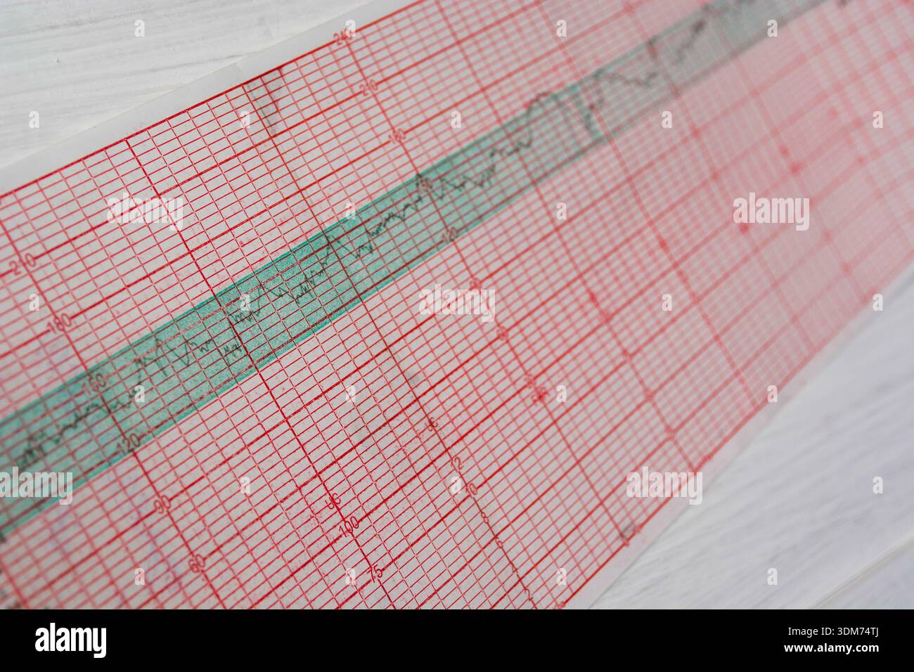 Sheet heart cardiogram hi-res stock photography and images - Alamy