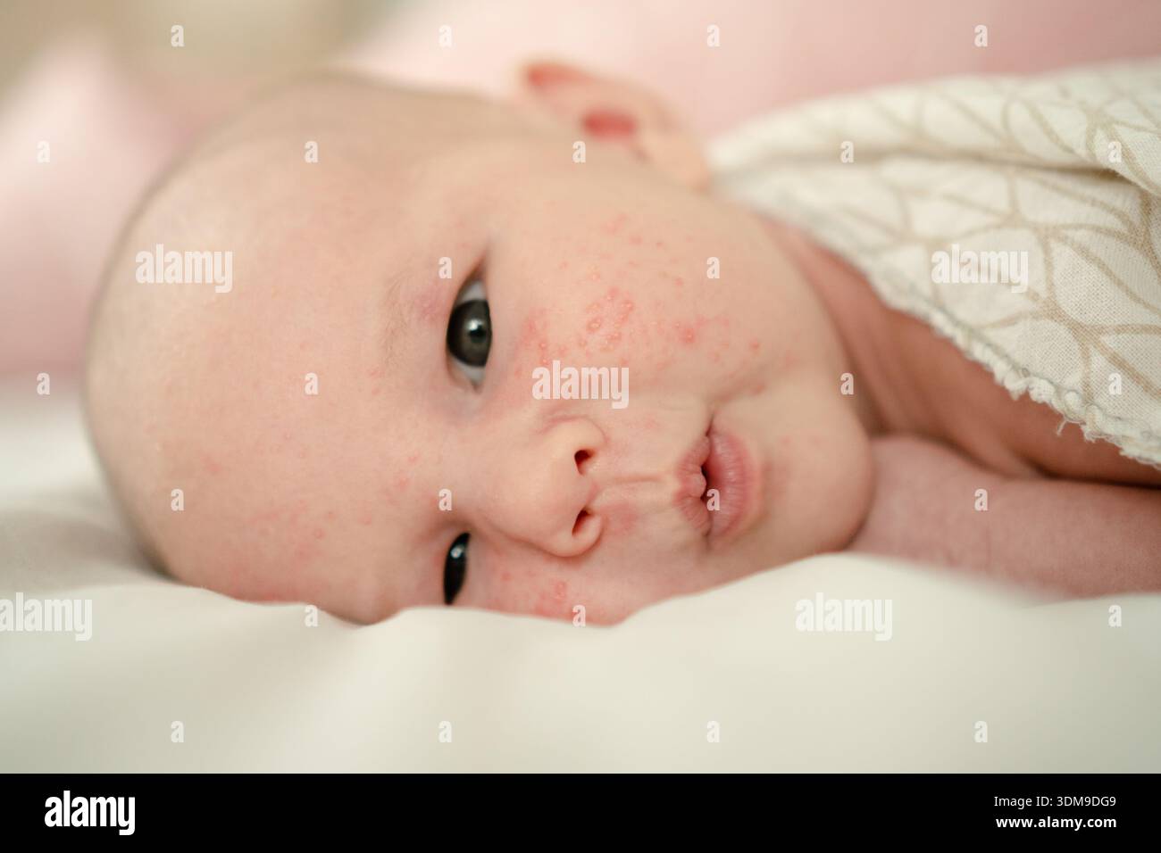 A tender portrait of a newborn baby with skin adaptation rash and tiny ...