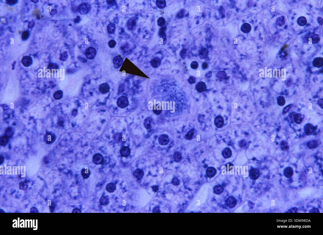 Photomicrograph at 500X magnification of rhesus monkey liver tissue ...