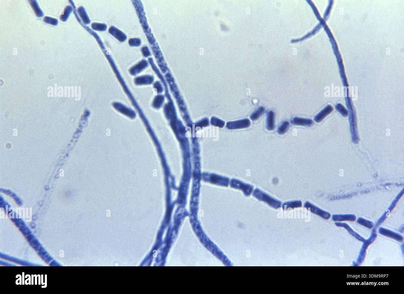 Photomicrograph at 970X shows ultrastructural features of the fungal ...