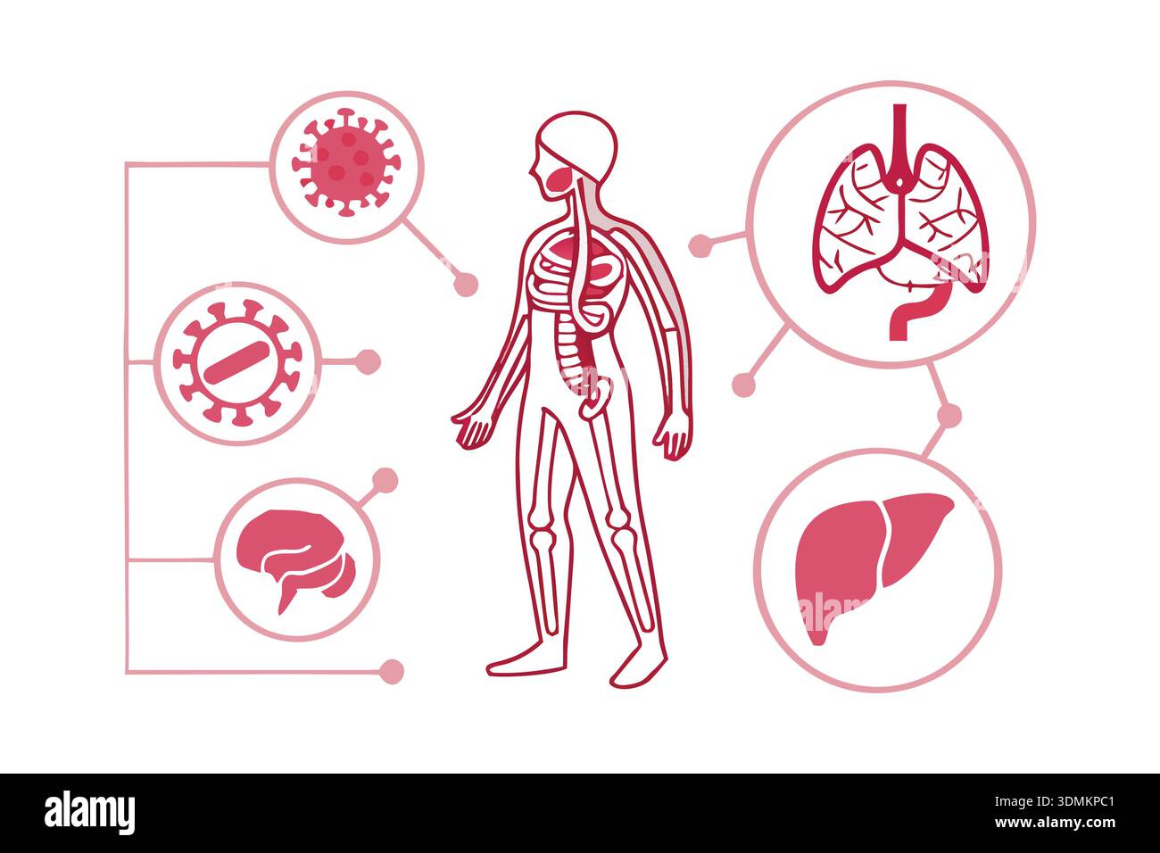 Symptom infographic vector vectors Stock Vector Images - Alamy