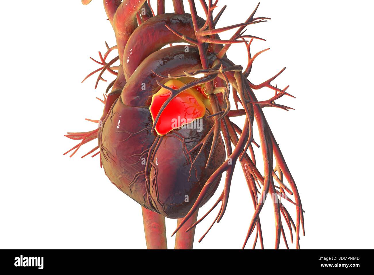 Illustration of the left atrium highlighted in red. The left atrium ...
