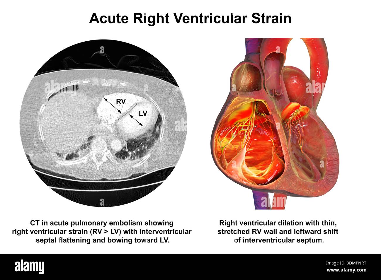 Ct Scan Diagram