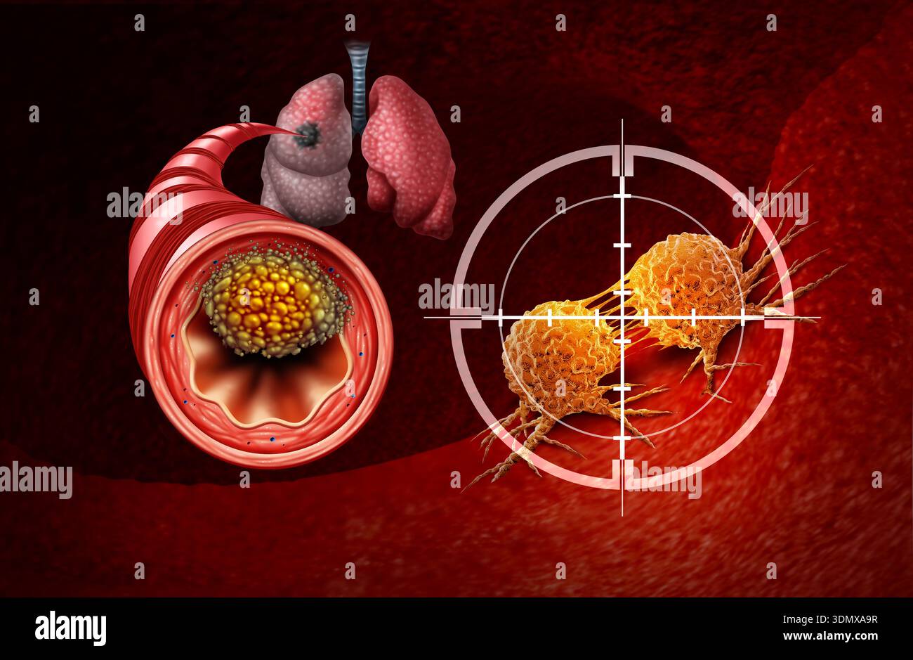 Lung Cancer Treatment and Small Cell Lung Cancers as a Central ...