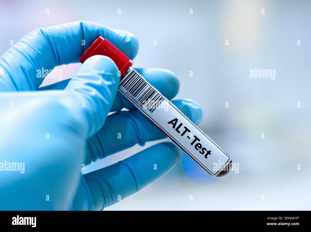 Blood sample tube for alanine transaminase (ALT) test analysis Stock ...