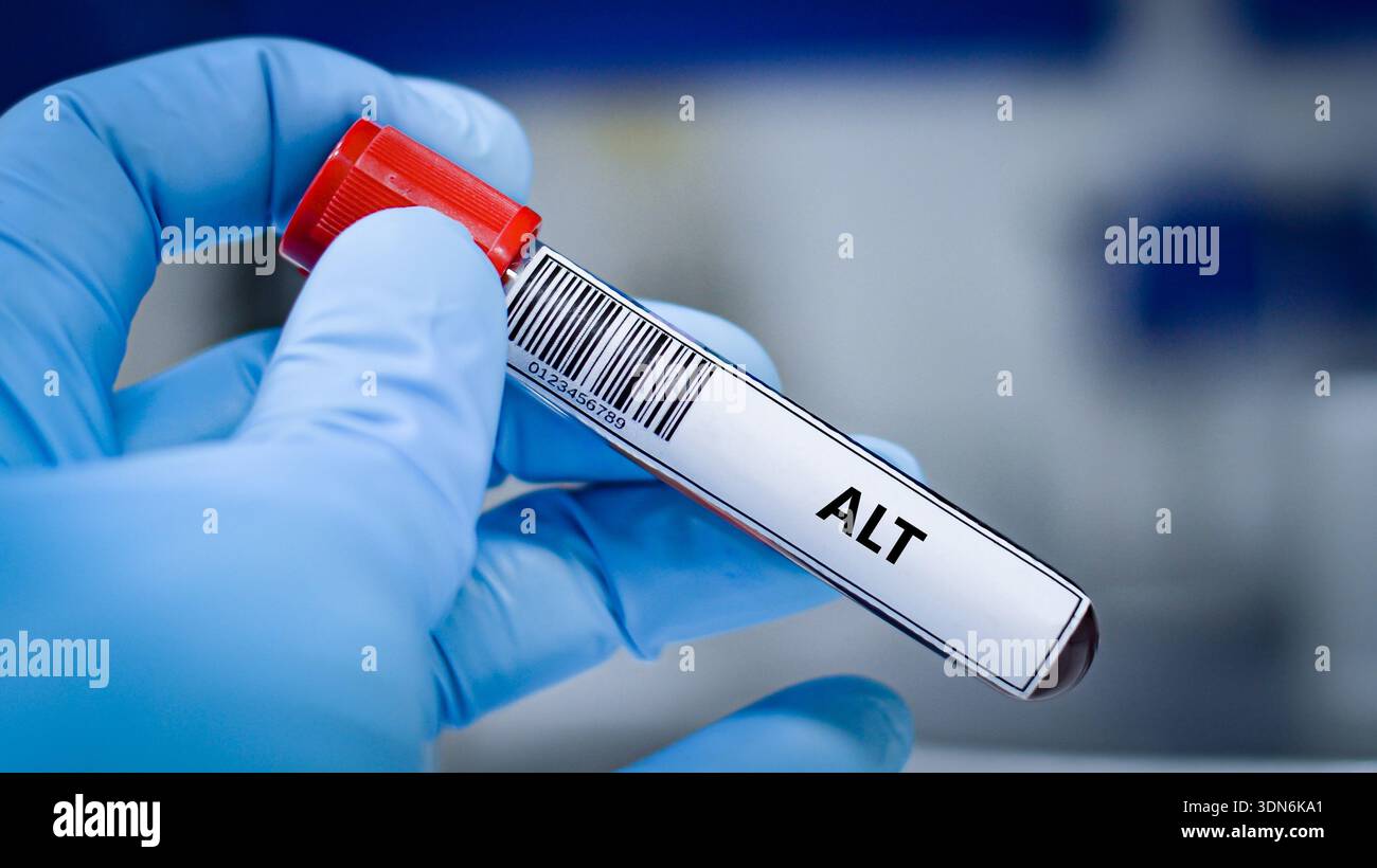 Blood sample tube for alanine transaminase (ALT) test analysis Stock ...