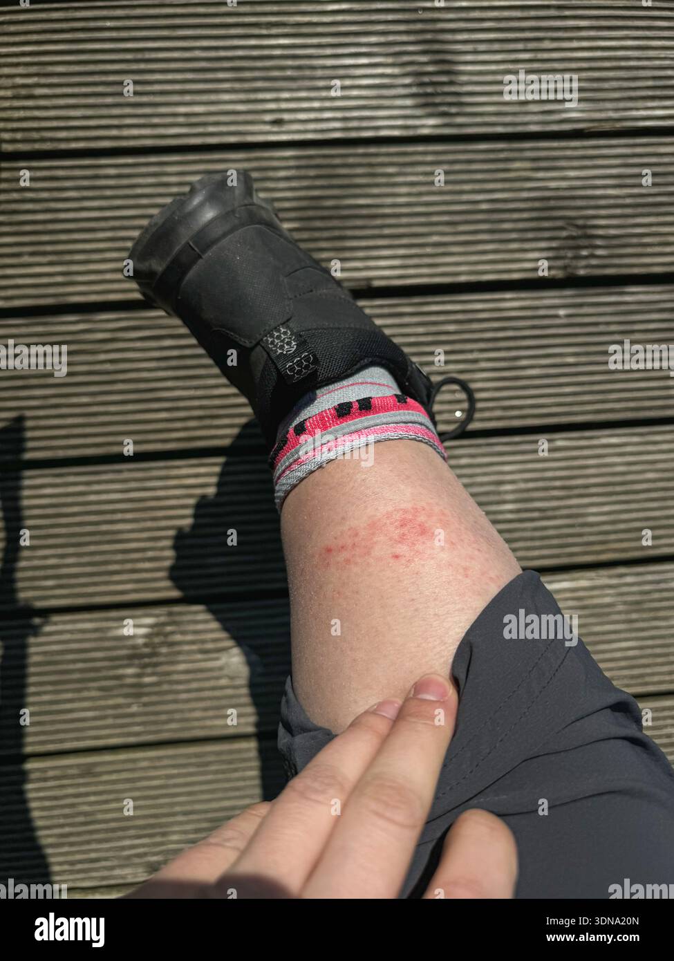 avoid-hiker-rash-7-tips-for-comfortable-hiking-adventures
