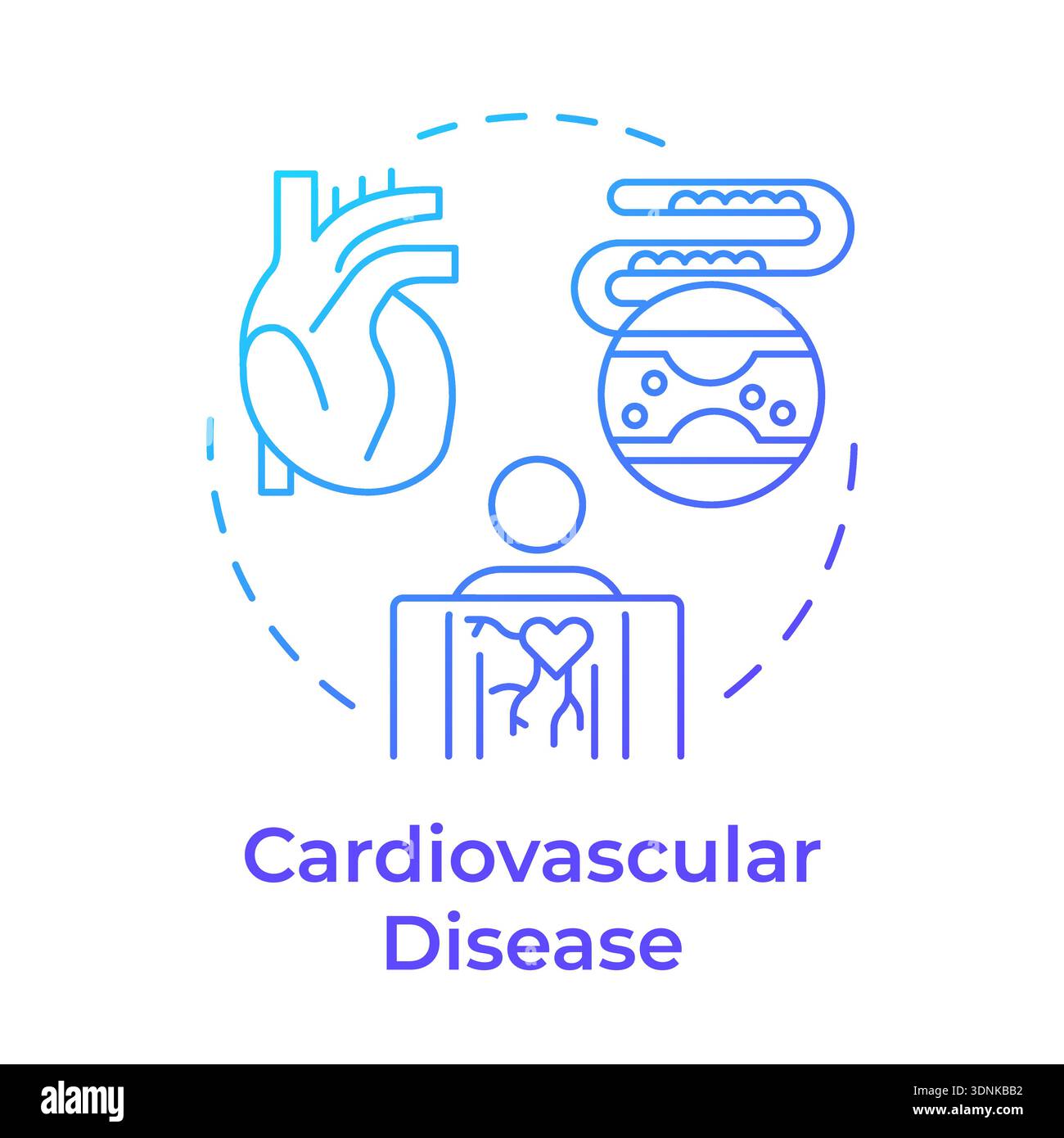 Cardiovascular disease blue gradient concept icon Stock Vector
