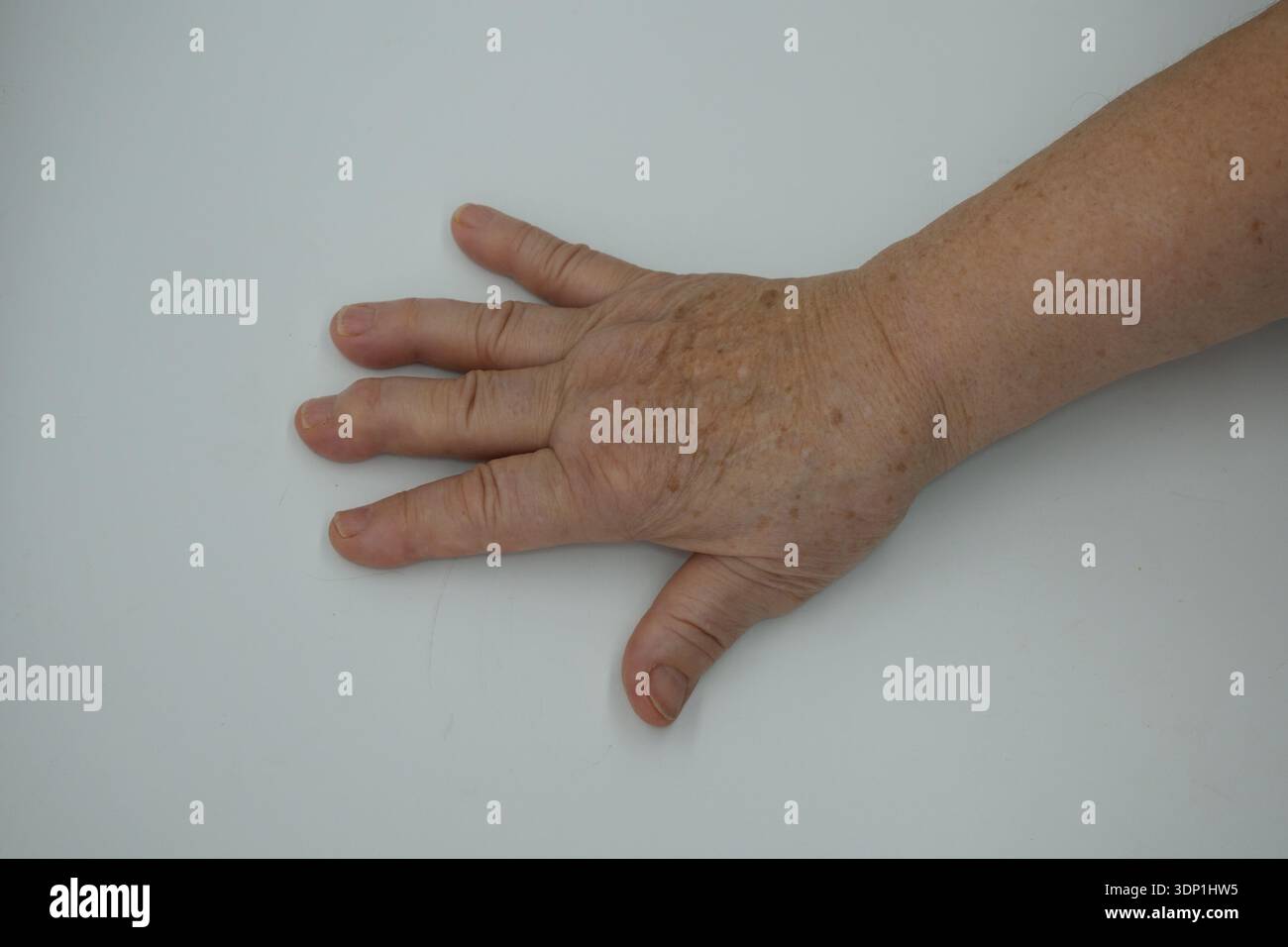 Skin anatomy hi-res stock photography and images - Alamy