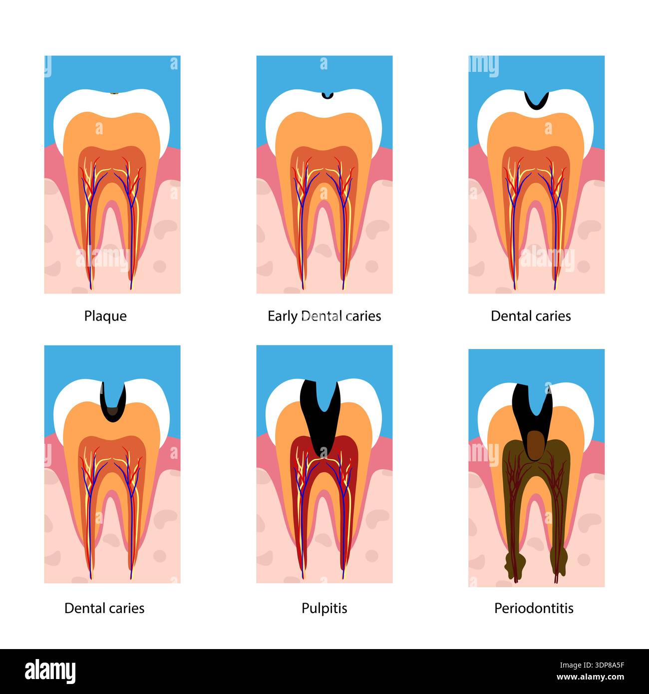 Hand-drawn dental infographic illustrating tooth anatomy and stages of ...
