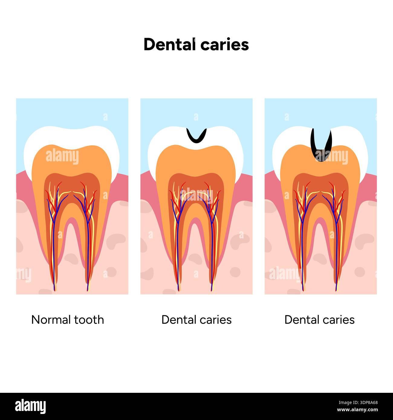 Hand-drawn dental infographic illustrating tooth anatomy and stages of ...