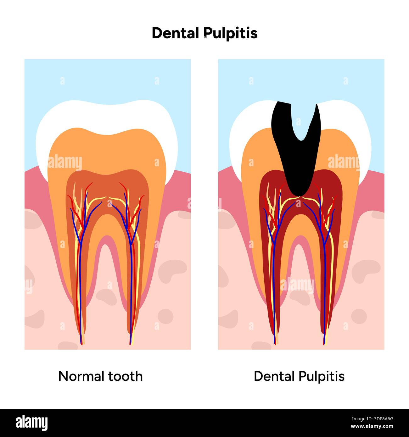 Dental crosssection hi-res stock photography and images - Alamy