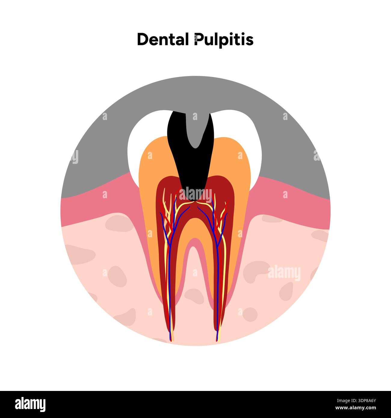 Dental crosssection hi-res stock photography and images - Alamy